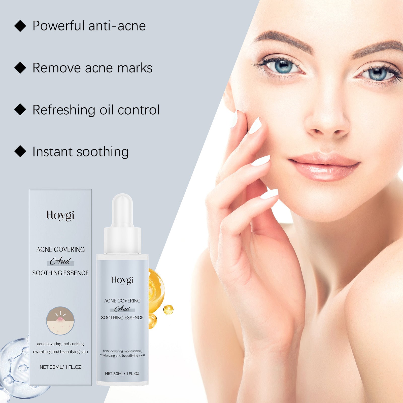 Acne Soothing Solution Facial Skin Hydrating