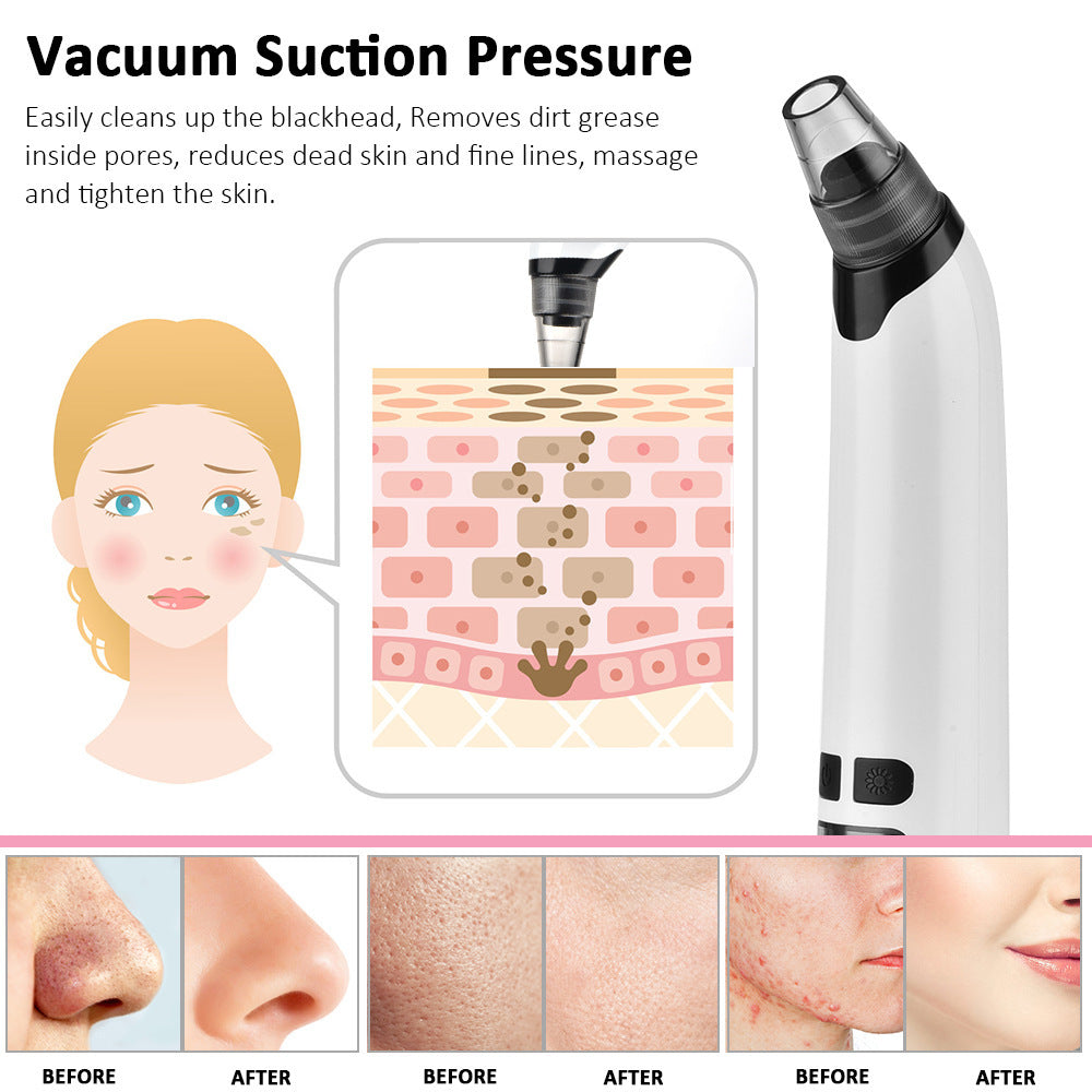 Clean Blackhead Meter Charging Beauty Equipment